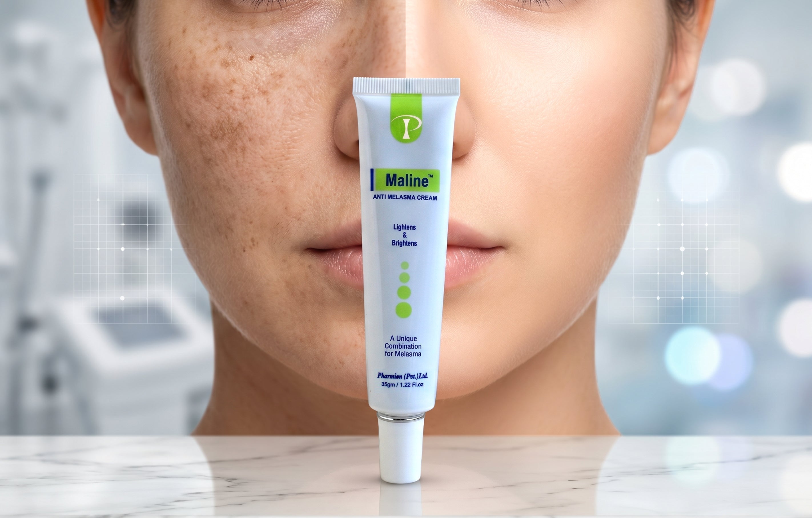 How to Effectively Treat Melasma and Dark Spots with “Maline” Antimelasma Cream